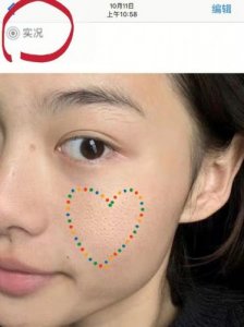 ​怎么缩毛孔粗大？怎么缩毛孔去黑头