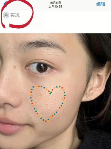 怎么缩毛孔粗大？怎么缩毛孔去黑头-第1张图片-