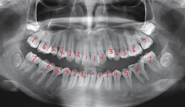 爱牙日的由来是什么(世界爱牙日的由来)