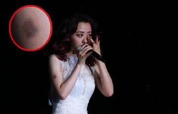 张靓颖为冯轲打乳环钉图片,公司前员工爆料张靓颖被冯轲控制虐待